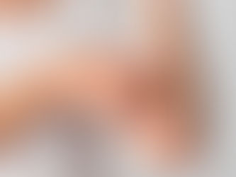 Dancing with Eczema: PRF, Cellular Healing Power for Eczema Relief