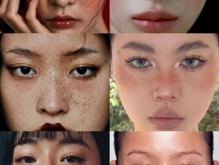 亲爱的读者,您好!我是 Dr. Vera,您的护肤伴侣。最近在门诊中,我观察到一个非常有趣的现象: 一方面,不少年轻人热衷画上“雀斑妆”,想要营造自然可爱的风格;另一方面,又有很多患者苦恼于天生雀斑,想尽办法要“清除干净”。这一矛盾现象背后,正反映出人们对“雀斑”认知的复杂性。 今天就让我从医学美容的角度,和你聊聊雀斑:它到底是什么?该不该治疗?又该如何处理,才科学又安心?