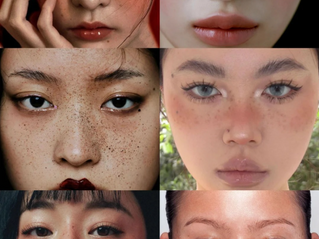 亲爱的读者,您好!我是 Dr. Vera,您的护肤伴侣。最近在门诊中,我观察到一个非常有趣的现象: 一方面,不少年轻人热衷画上“雀斑妆”,想要营造自然可爱的风格;另一方面,又有很多患者苦恼于天生雀斑,想尽办法要“清除干净”。这一矛盾现象背后,正反映出人们对“雀斑”认知的复杂性。 今天就让我从医学美容的角度,和你聊聊雀斑:它到底是什么?该不该治疗?又该如何处理,才科学又安心?