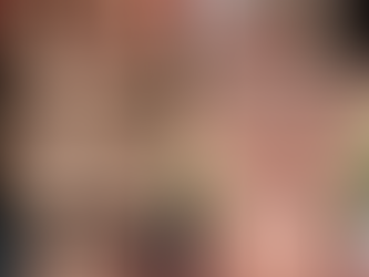 亲爱的读者,您好!我是 Dr. Vera,您的护肤伴侣。最近在门诊中,我观察到一个非常有趣的现象: 一方面,不少年轻人热衷画上“雀斑妆”,想要营造自然可爱的风格;另一方面,又有很多患者苦恼于天生雀斑,想尽办法要“清除干净”。这一矛盾现象背后,正反映出人们对“雀斑”认知的复杂性。 今天就让我从医学美容的角度,和你聊聊雀斑:它到底是什么?该不该治疗?又该如何处理,才科学又安心?