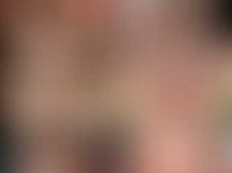 亲爱的读者,您好!我是 Dr. Vera,您的护肤伴侣。最近在门诊中,我观察到一个非常有趣的现象: 一方面,不少年轻人热衷画上“雀斑妆”,想要营造自然可爱的风格;另一方面,又有很多患者苦恼于天生雀斑,想尽办法要“清除干净”。这一矛盾现象背后,正反映出人们对“雀斑”认知的复杂性。 今天就让我从医学美容的角度,和你聊聊雀斑:它到底是什么?该不该治疗?又该如何处理,才科学又安心?