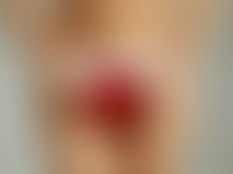 Navigating the Landscape of Female Genital Aesthetics