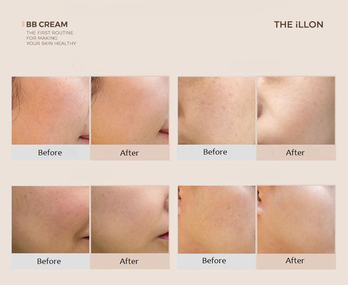 The iLLON BB Cream 30g (SPF35 PA++) | Lo Ah Skin Care