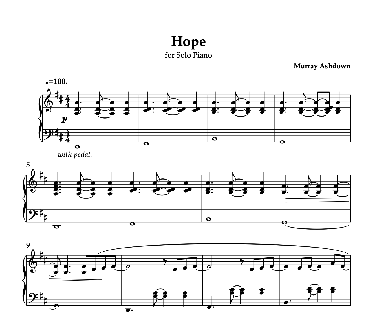 Murray Ashdown - Hope