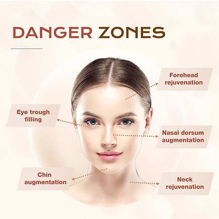 Danger Zones to inject Aesthefill.png