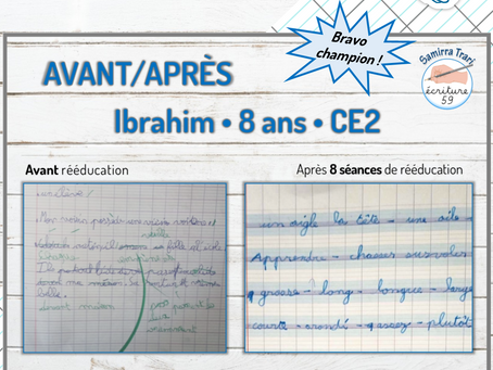 Avant/Après d'Ibrahim 8ans