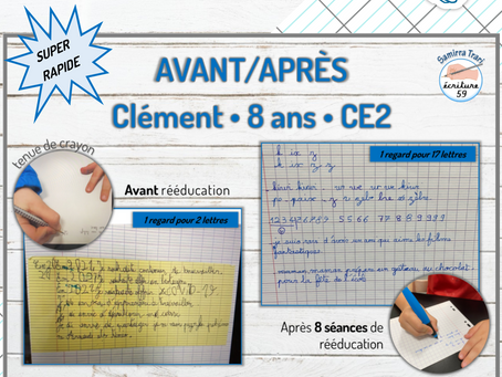 Avant/Après de Clément 8ans