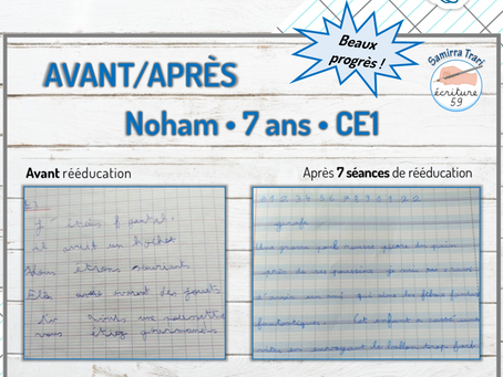 Avant/Après de Noham 7ans