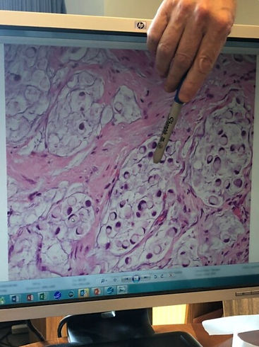 cancer-page-pic-225x300_2x.jpg