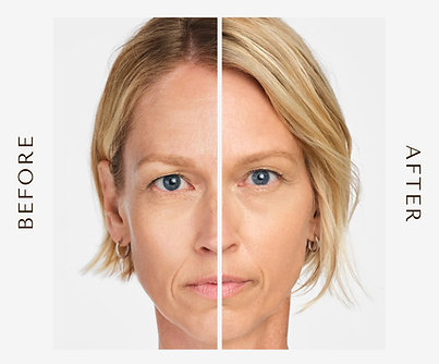 Black and White Minimalist Before After Beauty Instagram Post (1).png