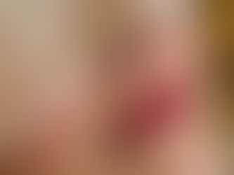 Hvordan ta best vare på leppene etter leppebehandling?