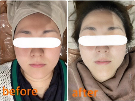 復元パックについてのご紹介です