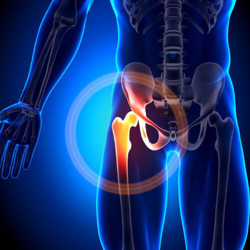 Hip and Groin Pain?