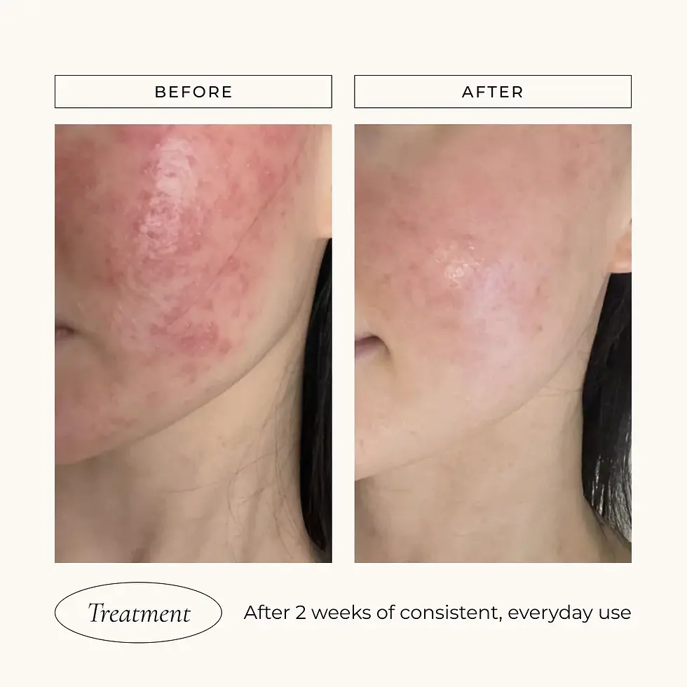 Thumbnail: Le Mieux Iso-Cell Recovery Solution - 5.1 oz.