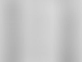 Attention deficit hyperactivity disorder -ADHD