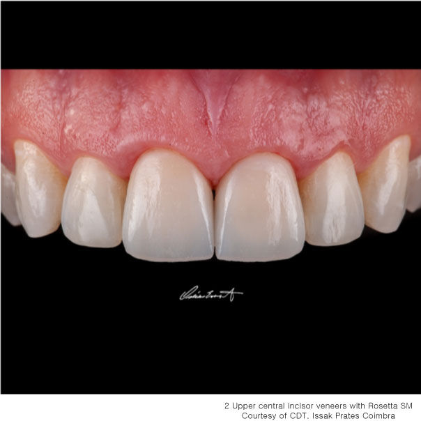 תמונה ממוזערת: Rosetta® SM
