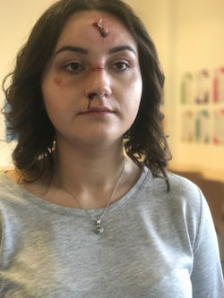 Special effects car crash look.