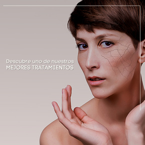 ¡Di NO a la piel con imperfecciones!