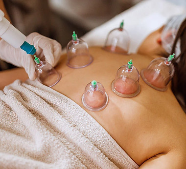 Cupping massage therapy
