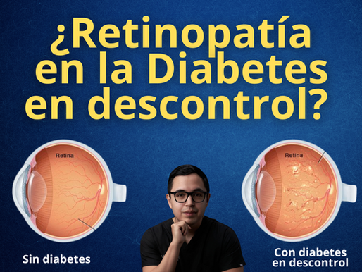 Retinopatía En Diabetes