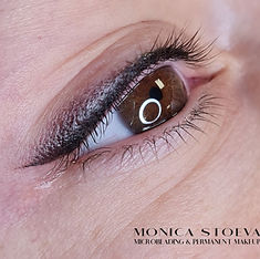 Eye Micropigmentation Treatment