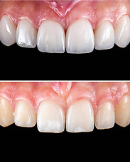 istockphoto-1480624434-612x612.jpg