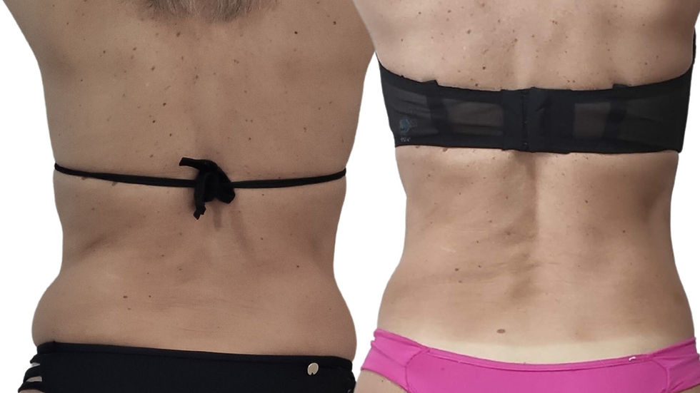 Non-Surgical : Achieve Your Summer Body Goals