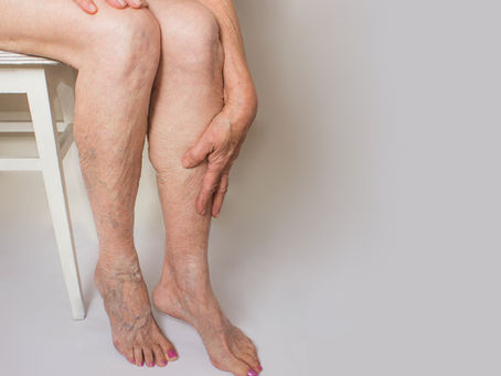 Elderly showing feet after footcare