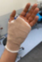 Carpal Tunnel Dressing