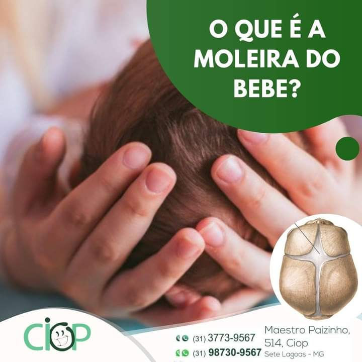 Moleira do bebê Moleira do bebê