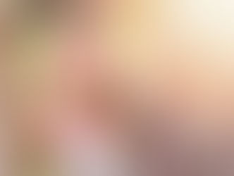 HIPERATIVIDADE INFANTIL