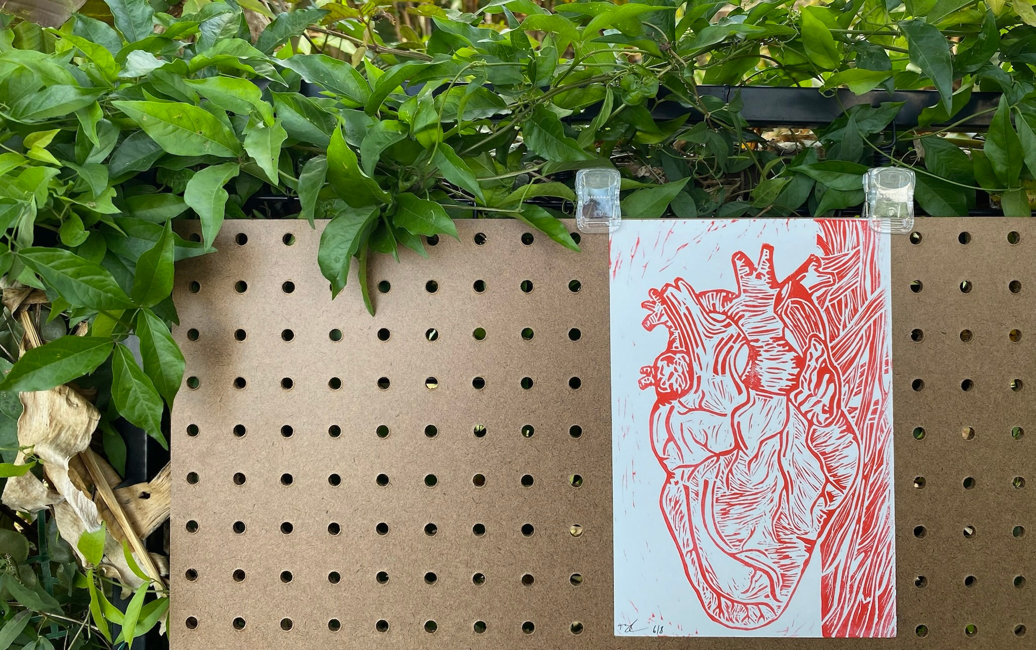 "Anatomical Heart" Block Print