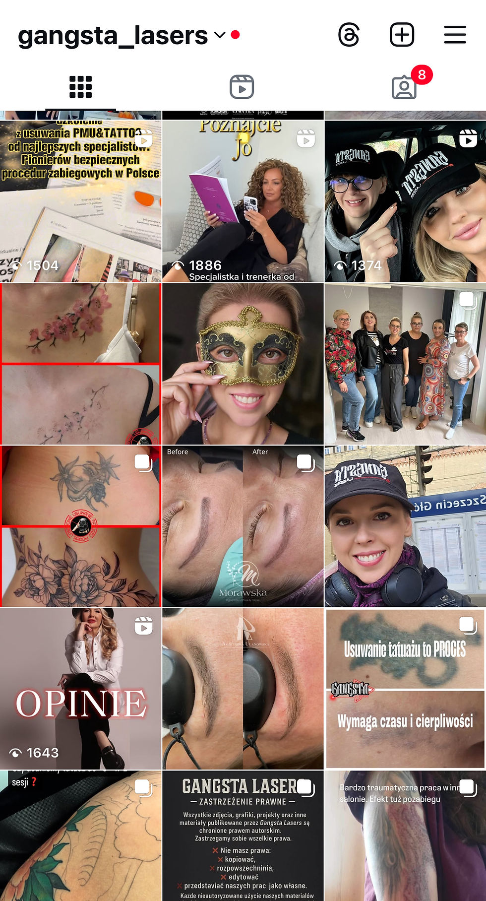 Jak atrakcyjnie i skutecznie pokazać zabiegi usuwania laserowego na profilu IG i FB by zachęcić klientki?