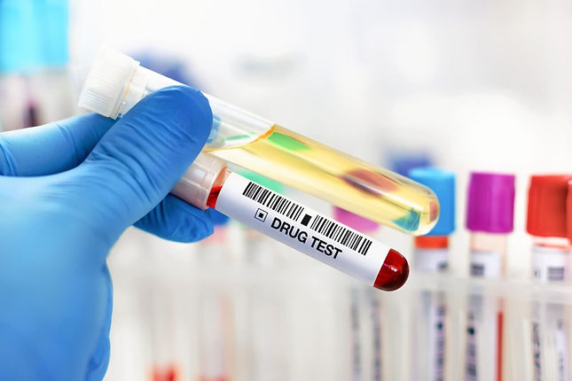 Simple Screening Drug Screening.jpeg
