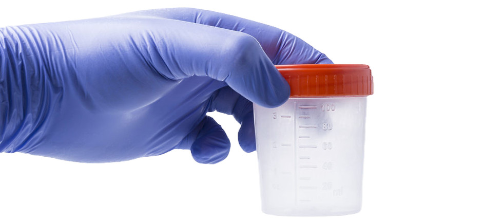 Simple Screening On-Site Drug screening_