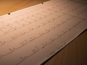 Impacto da Retatrutida na Saúde Cardiovascular: Benefícios Revelados
