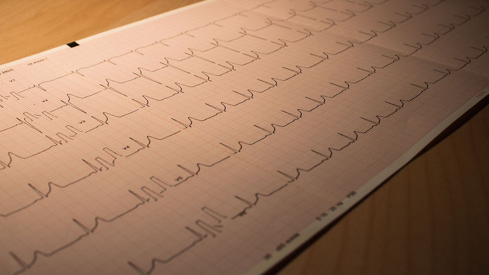 Close-up of an ECG printout depicting heart activity, placed on a wooden surface.