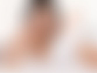 Gum Recession dentist downtown Montreal