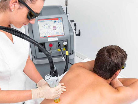 Épilation Laser pour Homme à Aix-en-Provence