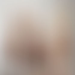 Rasage obligatoire avant une séance d’épilation laser