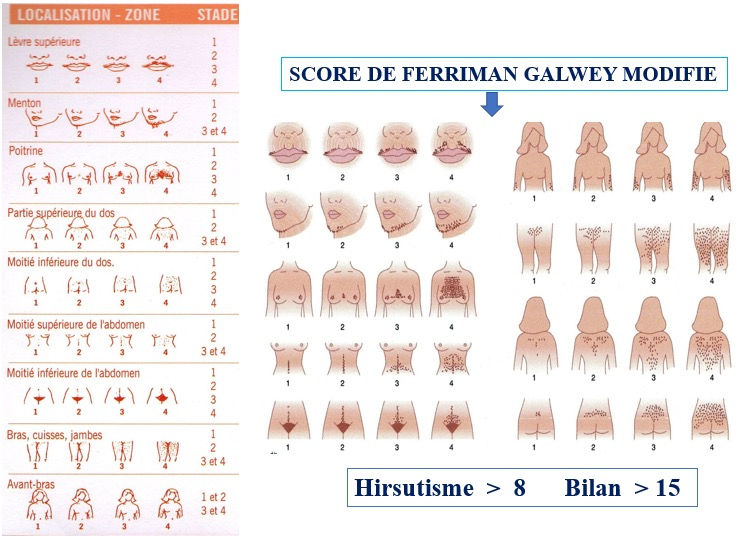 Score pilosité Aix en Provence