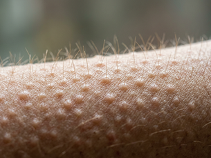 Why Do Goosebumps Happen When Youre Cold or Emotional