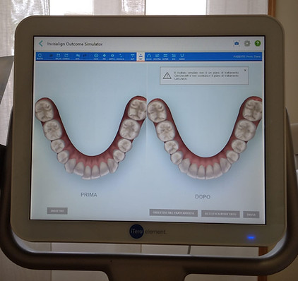 Studio Dentistico Radico questa foto contiene la Dottoressa Paola Radico al lavoro