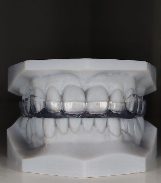 FERULA CADCAM.jpg