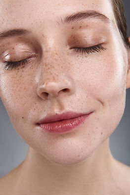 teora-freckles-2-web.jpg