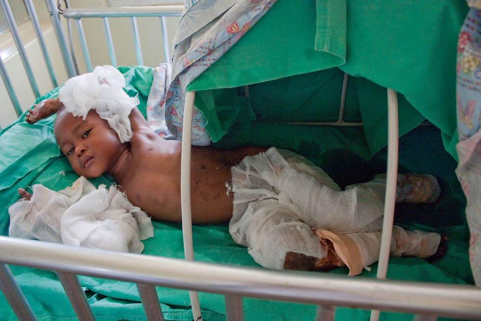 burried child, WCH