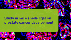 Study in mice sheds light on prostate cancer development