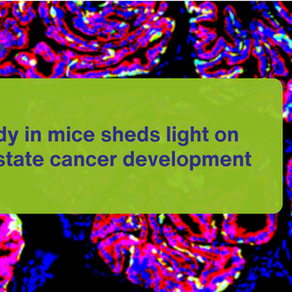 Study in mice sheds light on prostate cancer development
