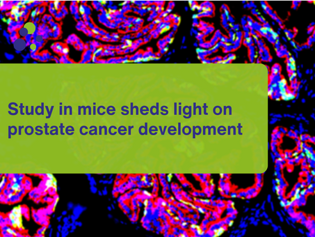 Study in mice sheds light on prostate cancer development