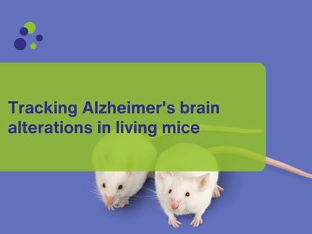 Tracking Alzheimer's brain alterations in living mice